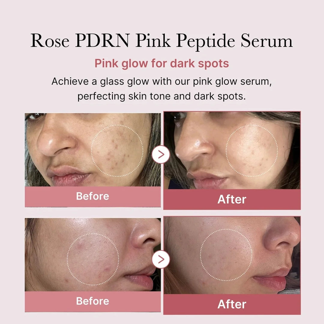 Medicube – PDRN Pink Glutathione Serum Mist | Bruma Iluminadora &amp; Reparadora · Antioxidante 100ml